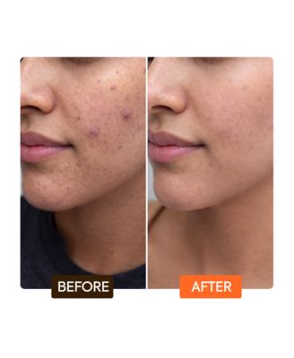 Naturalle Carotonic Extreme Glow Renewing Face Serum - 1.7oz