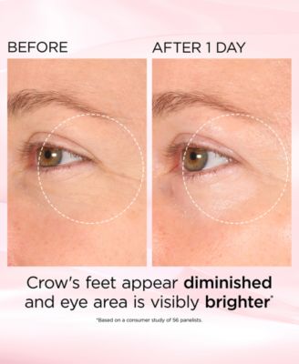 Retinol + HPR Ceramide Capsules Rapid Skin Renewing Eye Cream, 0.5 oz.