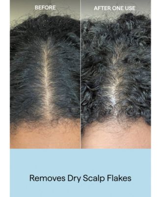 Scalp Revival Charcoal + Coconut Oil Exfoliating Shampoo, 8 oz.