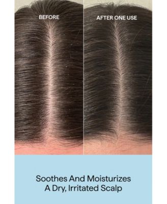 Scalp Revival Rosemary Pre-Wash Oil, 3.4 oz.