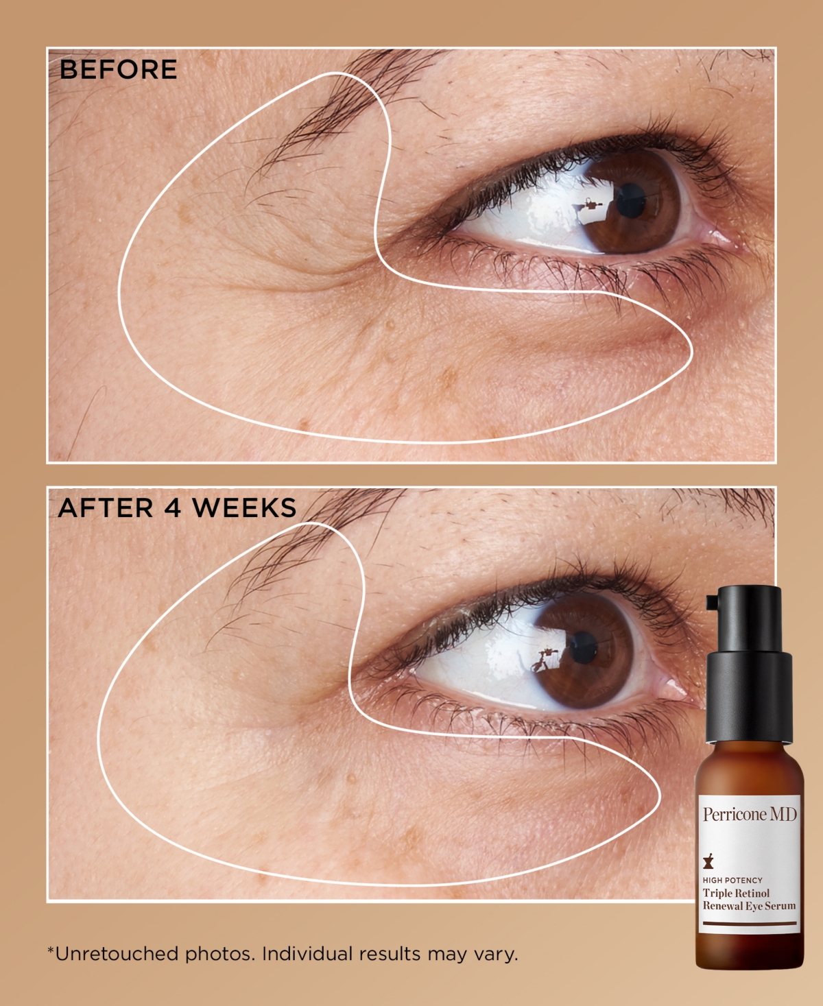 Perricone Md 3-Piece Triple Retinol Kit