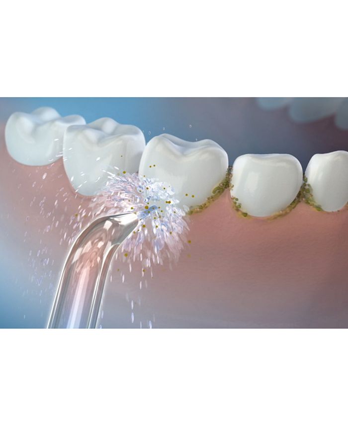 Waterpik JT450E Classic HighPressure Jet Tip Macy's