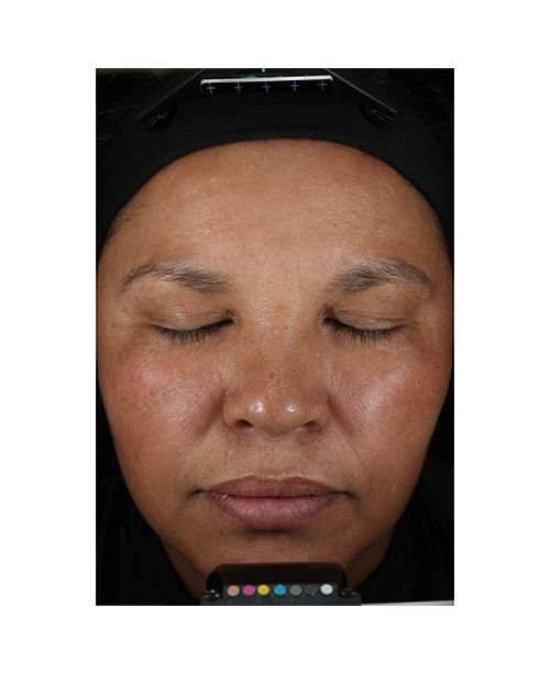Vitamin C Ester Brightening Amine Face Lift 2 Fl Oz