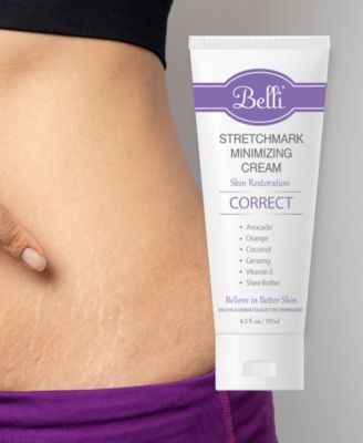 Stretchmark Minimizing Cream, 6.5 oz.