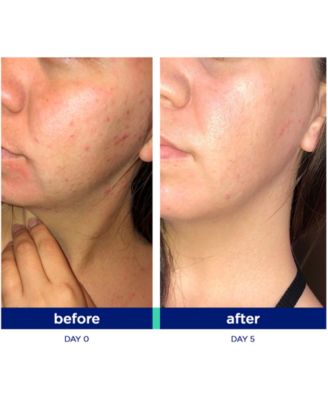 Clear & Renew Kick Trio System