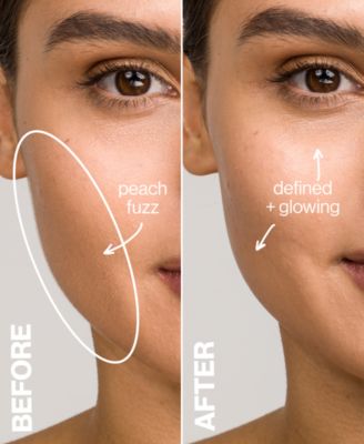 DERMAFLASH Luxe Exfoliation Device