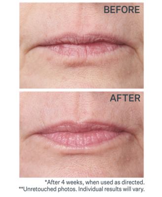 Double Fix For Lips Plumping & Vertical Line Treatment, 0.16-oz.