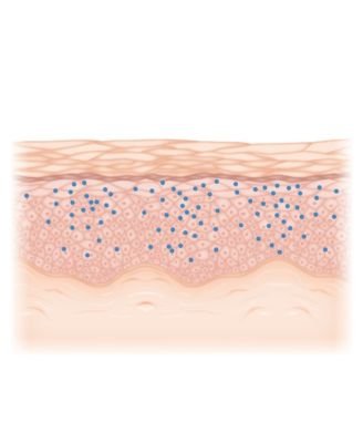 Women's TIME OFF Dissolving Hyaluronic Acid Microneedle Overnight Patch Treatment, 1 Month