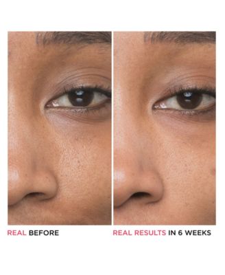 Bye Bye Pores 10% Glycolic Acid Concentrated Derma Serum