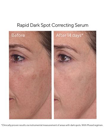 Murad - 4-Pc. Brighten Trial Set