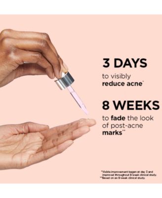 Bye Bye Breakout Serum