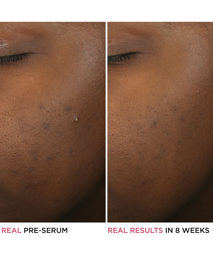 IT Cosmetics Bye Bye Breakout Serum Macy's