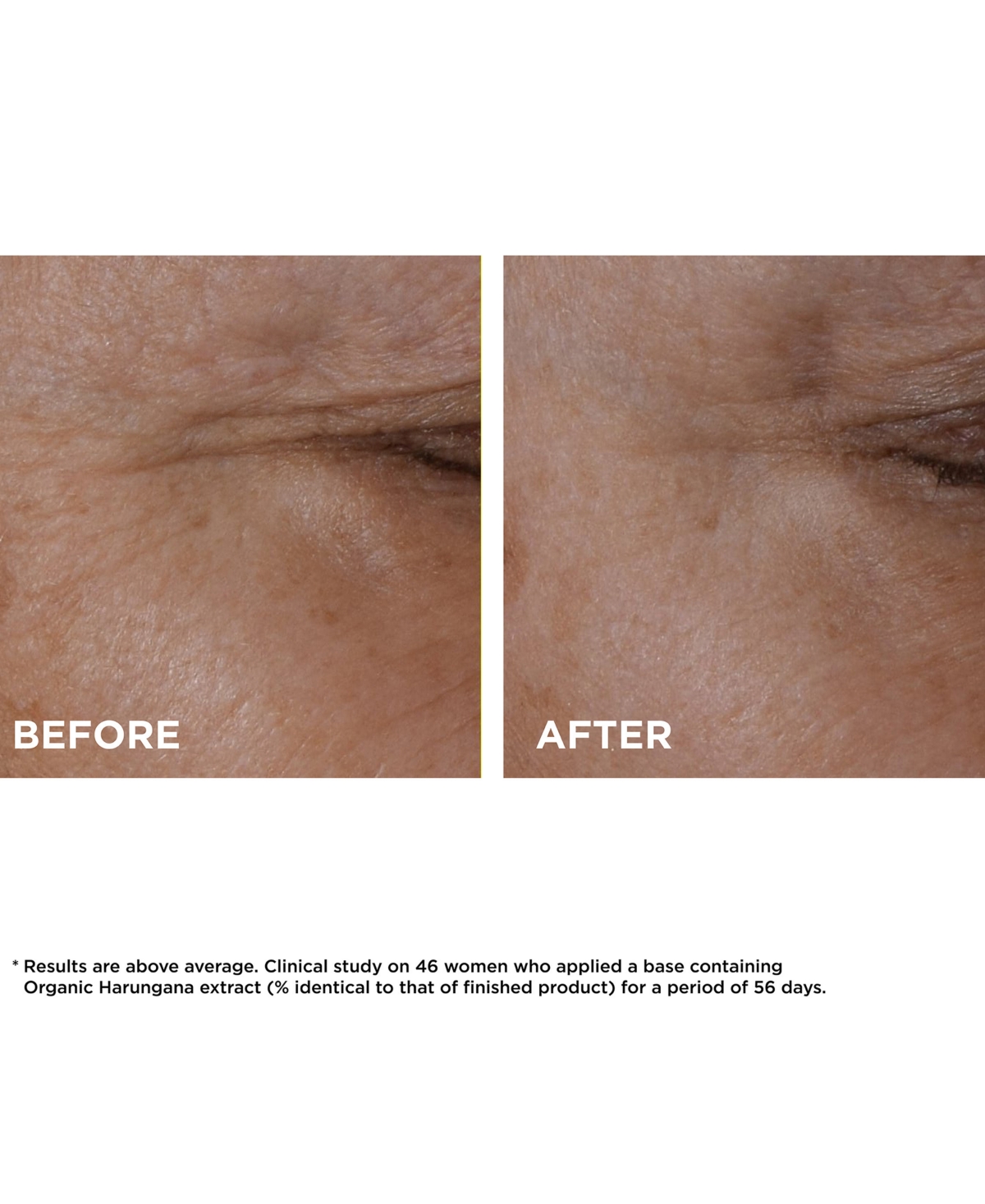 Clarins Total Eye Lift Firming & Smoothing Eye Cream, oz