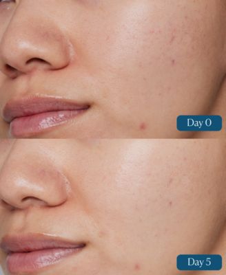 Dynamic Resurfacing Super-C Serum, 1 oz.