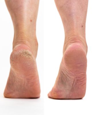 3 Step Pedicare with Rainforest Mist Argan Oil Set, Socks 6-9, 4 Piece