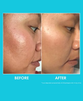 Moisture Whipped Ceramide Cream, 2.1 oz.