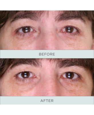 Tone Up Niacinamide Firming Eye Serum