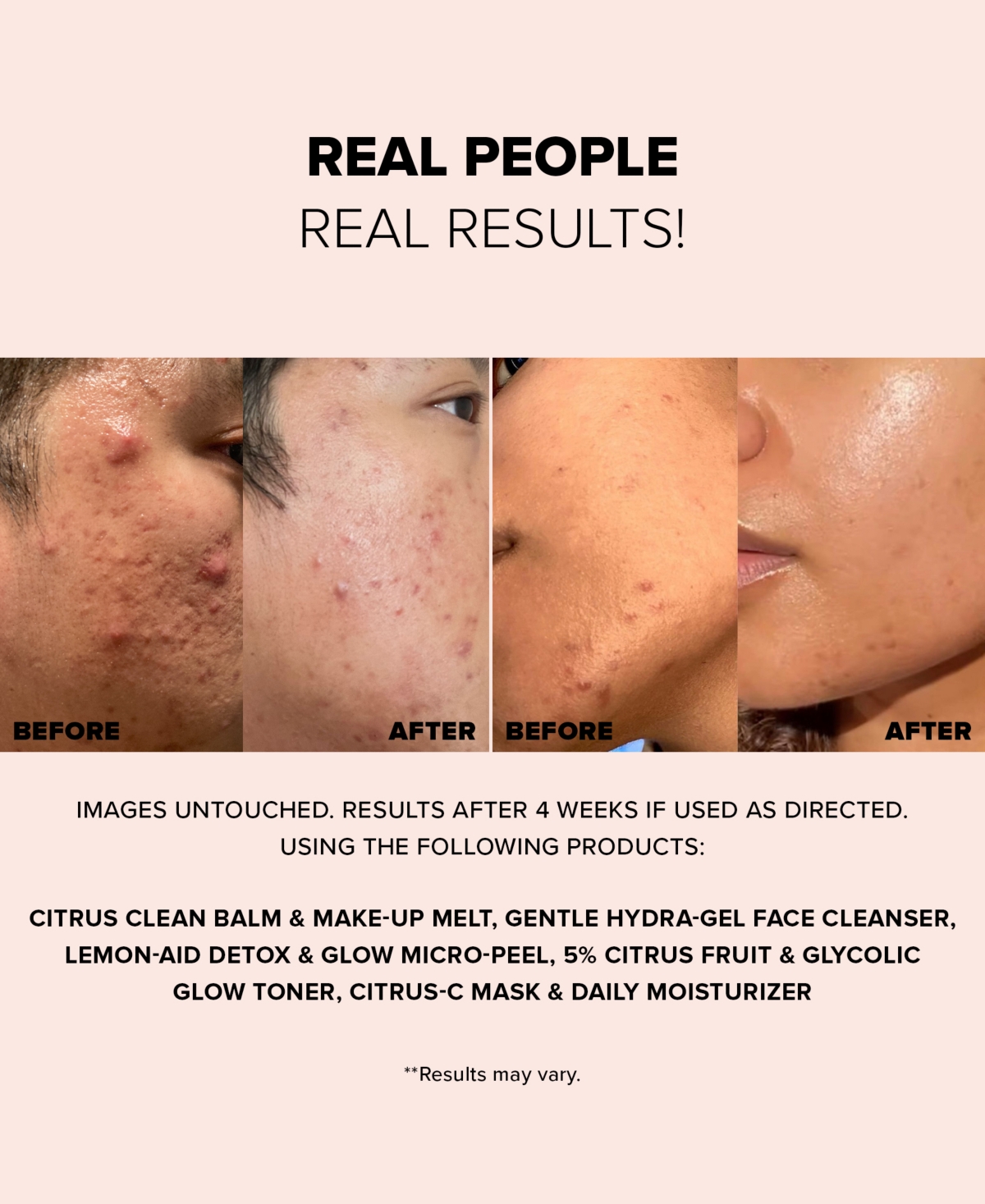 Nudestix Nudeskin Lemon-Aid Detox & Glow Micro-Peel, 2.03-oz