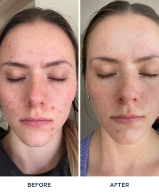 FR&Eacute; Purify Me Hydrating Facial Cleanser, 5oz.