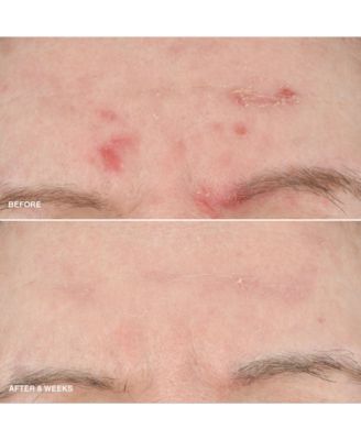 Vitamin Enriched Smoothing Niacinamide + Vitamin C Serum, 1 oz.