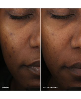 Vitamin Enriched Smoothing Niacinamide + Vitamin C Serum, 1 oz.