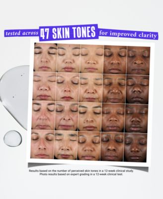 Dermatologist Solutions Clearly Corrective Dark Spot Solution, 3.8 oz.