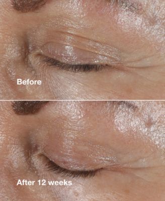 Smart Clinical Repair Wrinkle Correcting Eye Cream, 0.5oz