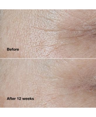 Smart Clinical Repair Wrinkle Correcting Face Cream, 0.5 oz.