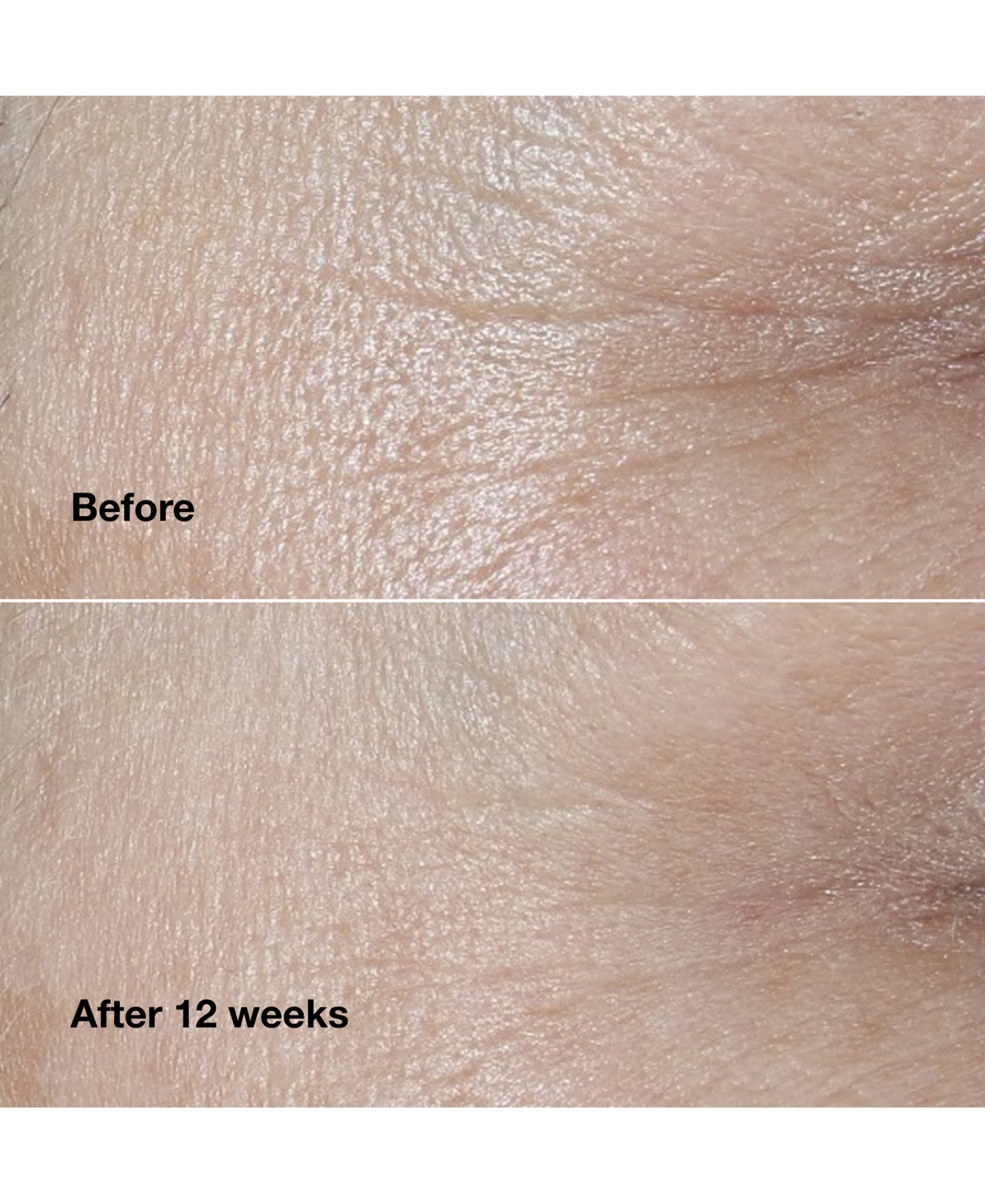 Clinique Smart Clinical Repair Wrinkle Correcting Face Cream