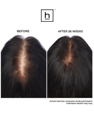 Ultima 9 Classic Lasercomb