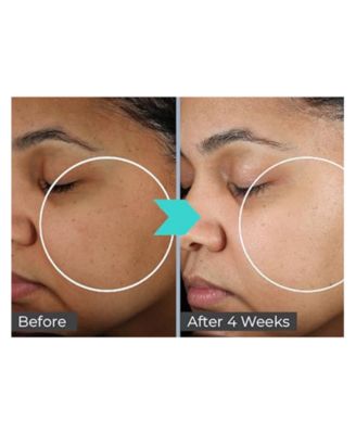 BeautyStat Universal Pro-Bio Moisture Boost Cream, 1.7 oz.