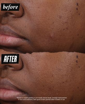 Auto-Tone Discoloration & UV Solution, 1.4 oz.