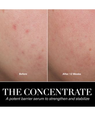 The Treatment Lotion, 3.4 oz.