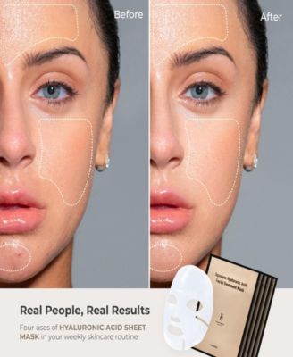 Anti-Aging Lifting Mask for Hydration and Acne, 5 Piece 