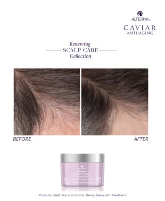 Renewing Scalp Care Scrub To Foam, 6 oz.