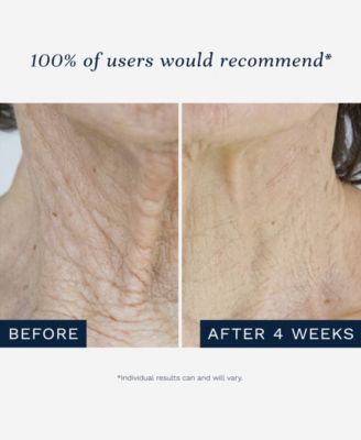 Invisicrepe Skin-Smoothing Balm, 5 Fl Oz/147 ML