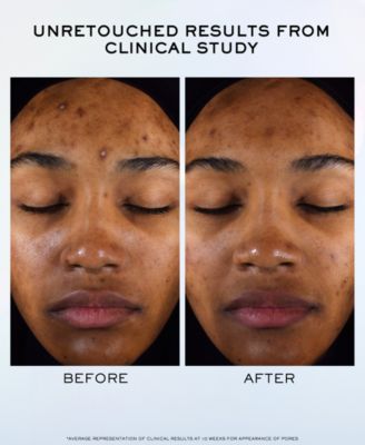 Clarifique Pro-Solution Brightening & Dark Spot Reducing Serum, 1.7 oz.