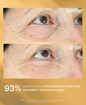 Hyperlift Eye Instant Eye Fix