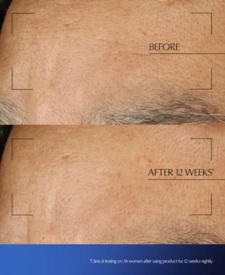 Advanced Night Repair Moisturizing Overnight Treatment with Hyaluronic Acid, 2.2 oz.