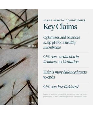 Scalp Remedy Conditioner, 6.7 oz.