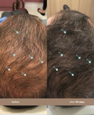 Spectral.DNC-N Hair Density Serum With Nanoxidil 5%, 60 ml