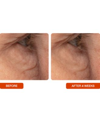 Universal C Eye Perfector Dark Circle Reducing Vitamin C Eye Cream