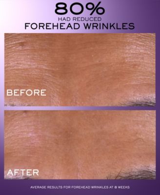 R&eacute;nergie C.R.x. Triple Serum Retinol, 1.7 oz. 