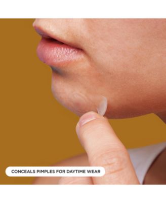 Hydrocolloid Overnight Pimple Patches – 224 Ct Mega Pack, Silk-Backed