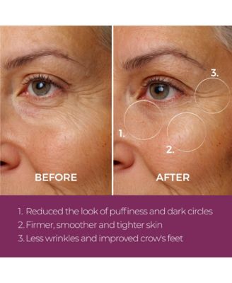 Eye Repair Peptide Complex