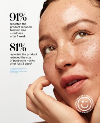 EradiKate Acne Mark Fading Gel, 1 oz.