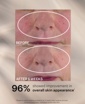 Advanced Retinol Nightly Multi-Correct Serum