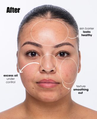 Breakout Breakup Purifying Salicylic Acid Cleanser For Oily & Blemish-Prone Skin, 5 oz.