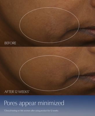 Limited-Edition Advanced Night Repair Synchronized Multi-Recovery Complex Serum with Hyaluronic Acid & Peptides, 50 ml