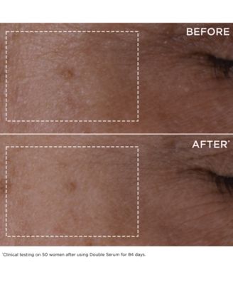 2-Pc. Double Serum Skin Care Set